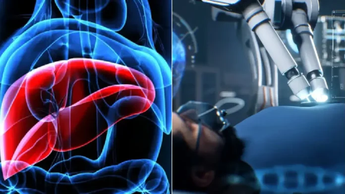 AI in liver disease 23.11