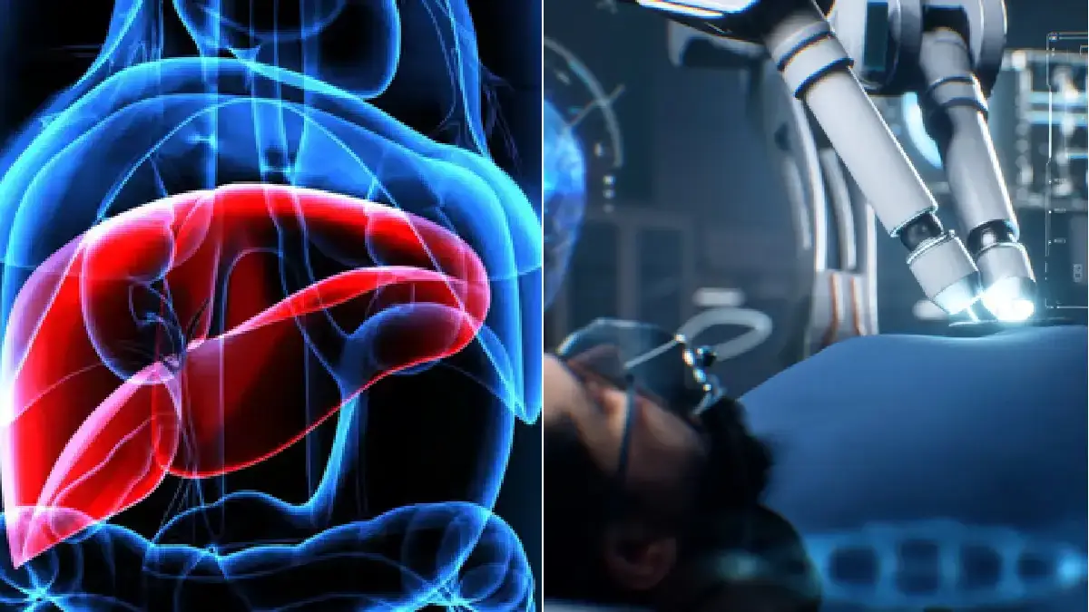 AI in liver disease 23.11