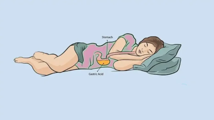 left sleeping