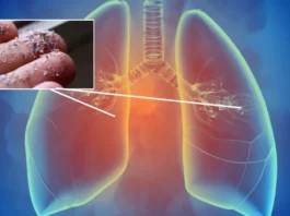 lung and plastic
