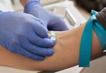 বিশ্বে সর্বাধিক যক্ষ্মা রোগী ভারতে, তবুও সংক্রমণ কমেছে ২১% — WHO-র গ্লোবাল টিবি রিপোর্টে মিশ্র চিত্র TB Test